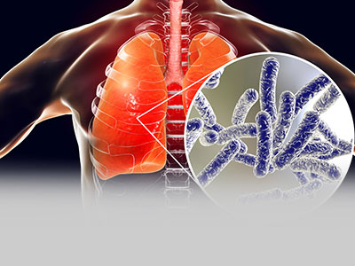 indoor air quality - lungs diagram